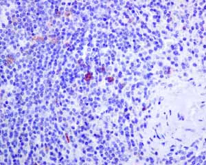 Immunohistochemistry (Formalin/PFA-fixed paraffin-embedded sections) - Anti-IL-2 Receptor alpha antibody [EPR6452] (AB128955)