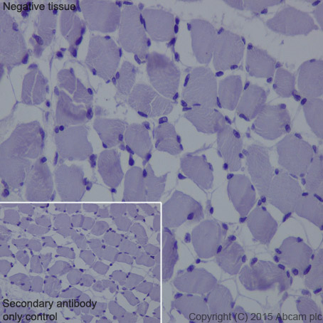 Immunohistochemistry (Formalin/PFA-fixed paraffin-embedded sections) - Anti-IL-2 Receptor alpha antibody [EPR6452] (AB128955), expandable thumbnail