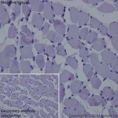 Immunohistochemistry (Formalin/PFA-fixed paraffin-embedded sections) - Anti-IL-2 Receptor alpha antibody [EPR6452] (AB128955)