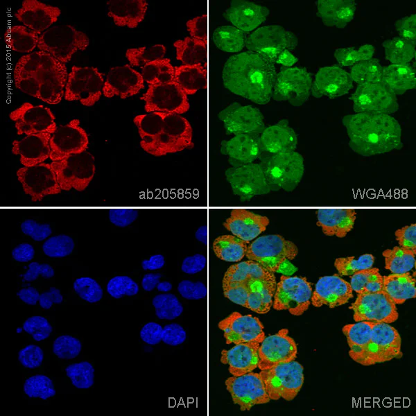 Immunocytochemistry/ Immunofluorescence - Anti-IL-2 Receptor alpha antibody [EPR6452] - BSA and Azide free (AB215378)