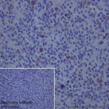 Immunohistochemistry (Formalin/PFA-fixed paraffin-embedded sections) - Anti-IL-2 Receptor alpha antibody [EPR6452] - BSA and Azide free (AB215378)