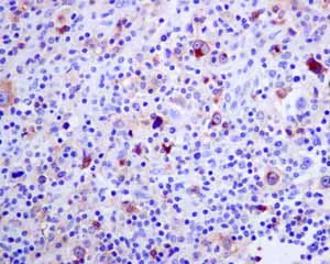 Immunohistochemistry (Formalin/PFA-fixed paraffin-embedded sections) - Anti-IL-2 Receptor alpha antibody [EPR6452] - BSA and Azide free (AB215378)