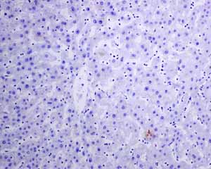 Immunohistochemistry (Formalin/PFA-fixed paraffin-embedded sections) - Anti-IL-2 Receptor alpha antibody [EPR6452] - BSA and Azide free (AB215378)
