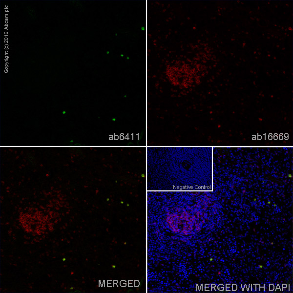 Immunohistochemistry (Frozen sections) - Anti-IL-2 Receptor alpha antibody [OX39] - BSA and Azide free (AB244557), expandable thumbnail
