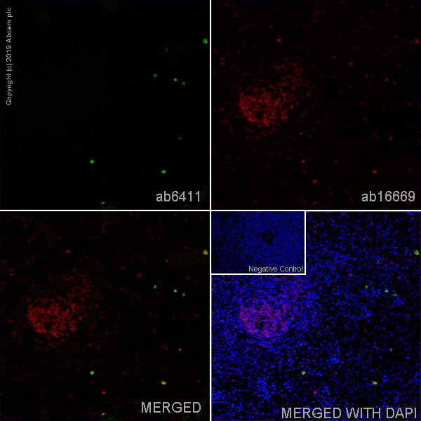 Immunohistochemistry (Frozen sections) - Anti-IL-2 Receptor alpha antibody [OX39] - BSA and Azide free (AB244557)