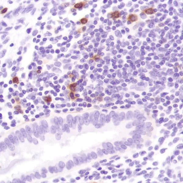 Immunohistochemistry (Formalin/PFA-fixed paraffin-embedded sections) - Anti-IL-2 Receptor alpha antibody [SP176] (AB231441)