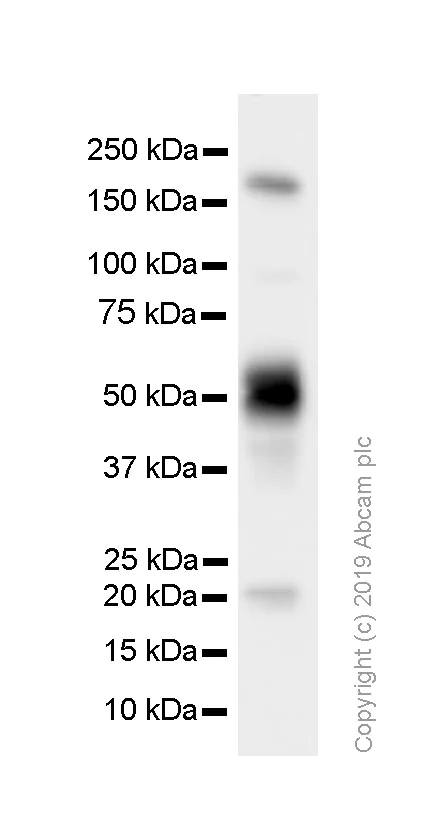 Western blot - Anti-IL-2 Receptor alpha antibody [SP176] (AB231441)