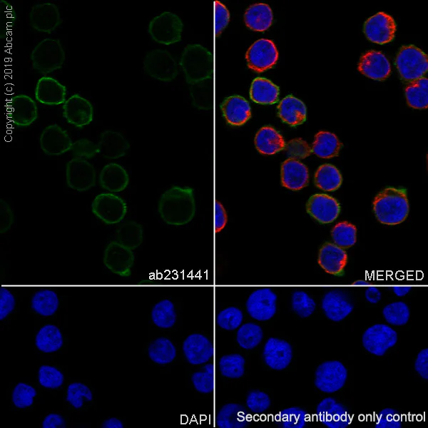 Immunocytochemistry/ Immunofluorescence - Anti-IL-2 Receptor alpha antibody [SP176] - BSA and Azide free (AB238272)
