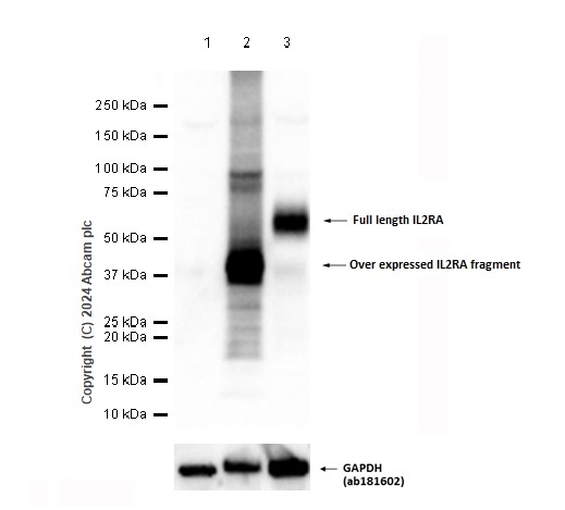 Western blot - Anti-IL-2 Receptor alpha antibody [SP176] - BSA and Azide free (AB238272), expandable thumbnail