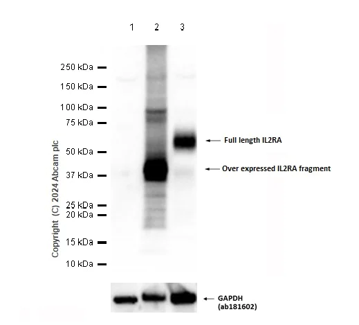 Western blot - Anti-IL-2 Receptor alpha antibody [SP176] - BSA and Azide free (AB238272)