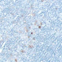 Immunohistochemistry (Formalin/PFA-fixed paraffin-embedded sections) - Anti-IL-2 Receptor alpha antibody [SP176], prediluted (AB150306)