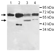 Western blot - Anti-IL-20R1 antibody (AB106740), expandable thumbnail