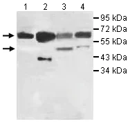 Western blot - Anti-IL-20R1 antibody (AB106740)