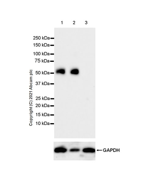 Western blot - Anti-IL-20R1 antibody [EPR24556-125] (AB273031)