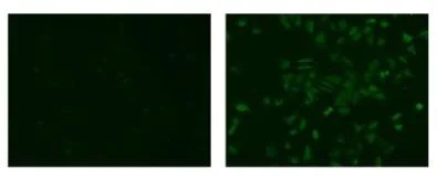 Immunocytochemistry/ Immunofluorescence - Anti-IL-20R2 antibody [20RNTC] (AB95824)