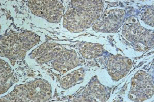 Immunohistochemistry (Formalin/PFA-fixed paraffin-embedded sections) - Anti-IL-20R2 antibody (AB124332)