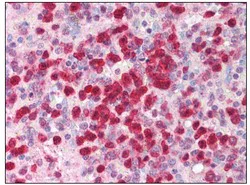 Immunohistochemistry (Formalin/PFA-fixed paraffin-embedded sections) - Anti-IL-21 antibody (AB118510)