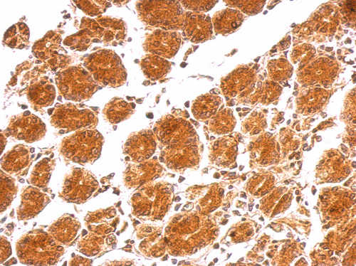 Immunohistochemistry (Formalin/PFA-fixed paraffin-embedded sections) - Anti-IL-21 antibody (AB154767), expandable thumbnail