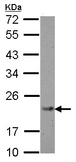 Western blot - Anti-IL-21 antibody (AB154767), expandable thumbnail