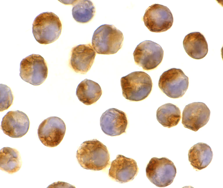 Immunocytochemistry/ Immunofluorescence - Anti-IL-21 antibody (AB5978)