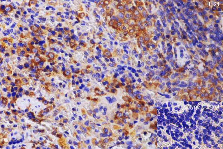 Immunohistochemistry (Formalin/PFA-fixed paraffin-embedded sections) - Anti-IL-21 antibody (AB5978)
