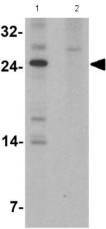 Western blot - Anti-IL-22 antibody (AB181007), expandable thumbnail