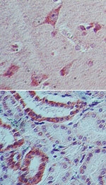 Immunohistochemistry (Formalin/PFA-fixed paraffin-embedded sections) - Anti-IL-22 antibody [IMG8F11E2] (AB134035)