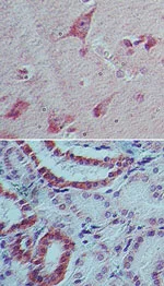Immunohistochemistry (Formalin/PFA-fixed paraffin-embedded sections) - Anti-IL-22 antibody [IMG8F11E2] (AB134035)