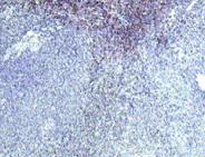 Immunohistochemistry (Formalin/PFA-fixed paraffin-embedded sections) - Anti-IL-22RA1 antibody (AB18568)
