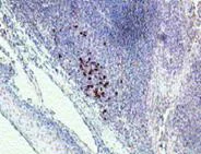 Immunohistochemistry (Formalin/PFA-fixed paraffin-embedded sections) - Anti-IL-22RA1 antibody (AB18568)