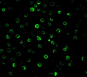 Immunocytochemistry/ Immunofluorescence - Anti-IL-22RA1 antibody (AB5984), expandable thumbnail