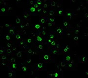 Immunocytochemistry/ Immunofluorescence - Anti-IL-22RA1 antibody (AB5984)