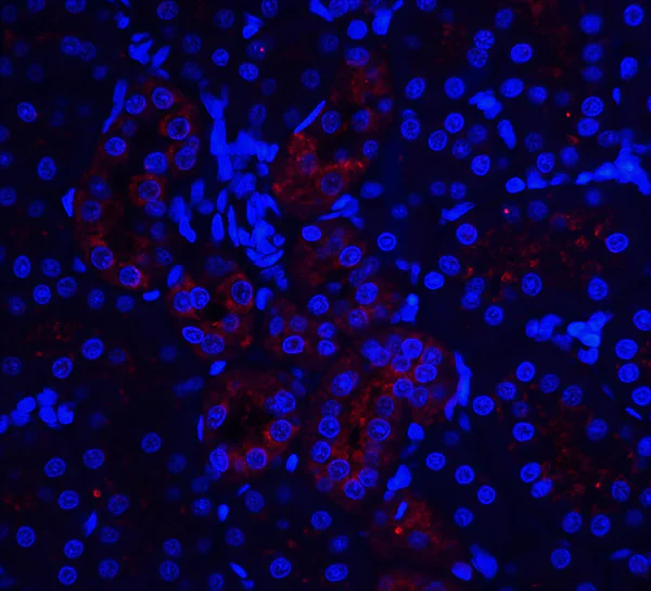 Immunohistochemistry (Formalin/PFA-fixed paraffin-embedded sections) - Anti-IL-22RA1 antibody (AB5984)