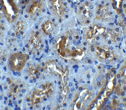 Immunohistochemistry (Formalin/PFA-fixed paraffin-embedded sections) - Anti-IL-22RA1 antibody (AB5984)