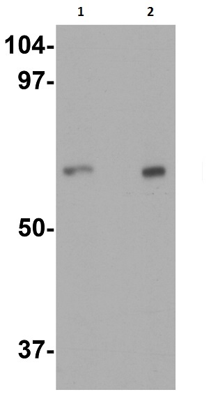 Western blot - Anti-IL-22RA1 antibody (AB5984), expandable thumbnail