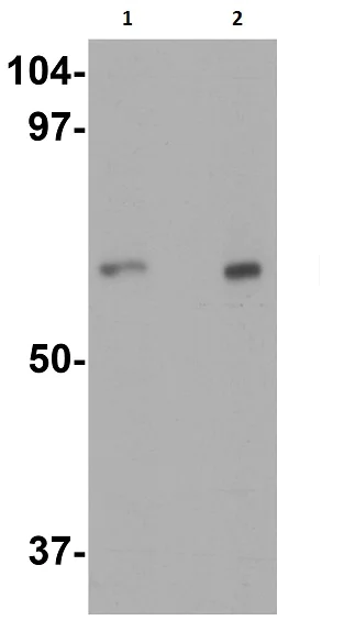 Western blot - Anti-IL-22RA1 antibody (AB5984)