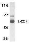 Western blot - Anti-IL-22RA1 antibody (AB5984)