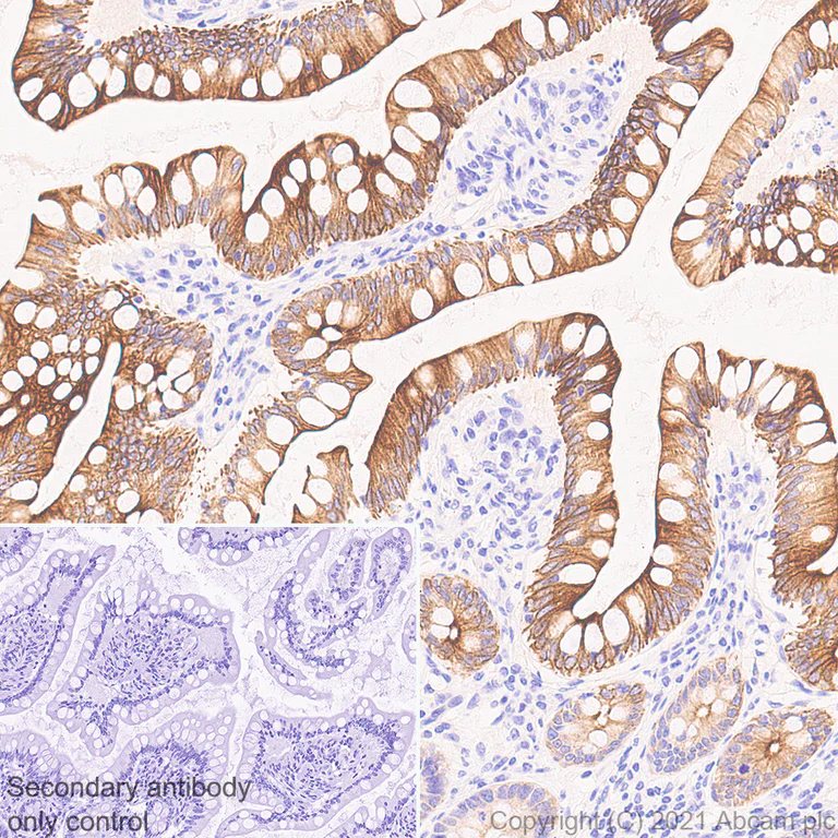 Immunohistochemistry (Formalin/PFA-fixed paraffin-embedded sections) - Anti-IL-22RA1 antibody [EPR24559-15] (AB283677)