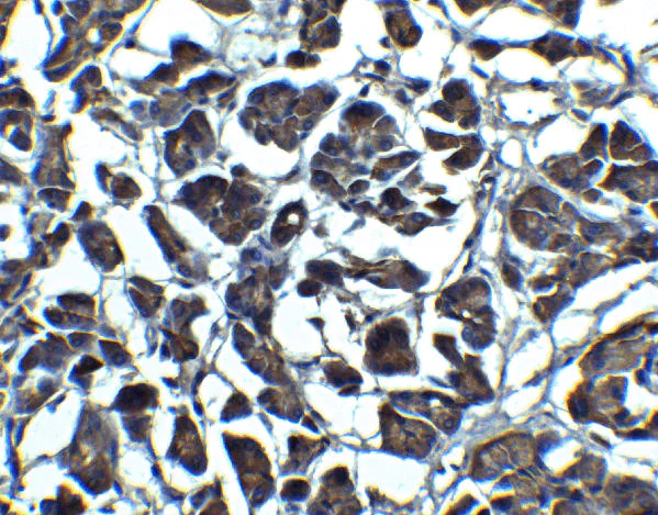 Immunohistochemistry (Formalin/PFA-fixed paraffin-embedded sections) - Anti-IL-23 antibody (AB45420)