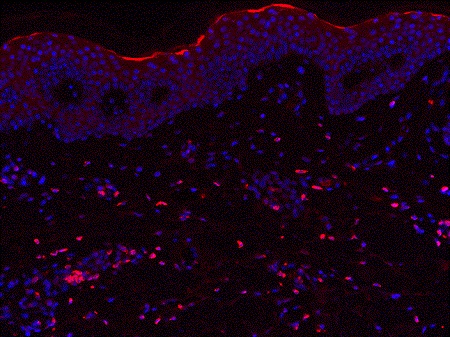 Immunohistochemistry (Formalin/PFA-fixed paraffin-embedded sections) - Anti-IL-23 antibody [B-Z23] - BSA and Azide free (AB84471), expandable thumbnail