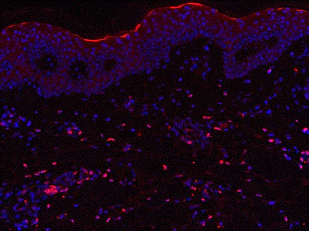 Immunohistochemistry (Formalin/PFA-fixed paraffin-embedded sections) - Anti-IL-23 antibody [B-Z23] - BSA and Azide free (AB84471)
