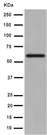 Western blot - Anti-IL-23 antibody [EPR5585(N)] - C-terminal (AB190356)