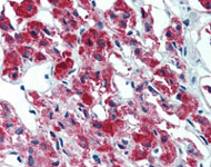 Immunohistochemistry (Formalin/PFA-fixed paraffin-embedded sections) - Anti-IL-23 antibody [HLT2736] (AB110630)