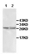 Western blot - Anti-IL-24 antibody (AB106277)
