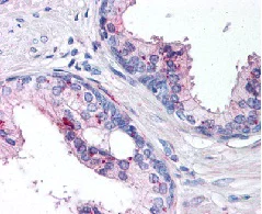 Immunohistochemistry (Formalin/PFA-fixed paraffin-embedded sections) - Anti-IL-24 antibody (AB115207)