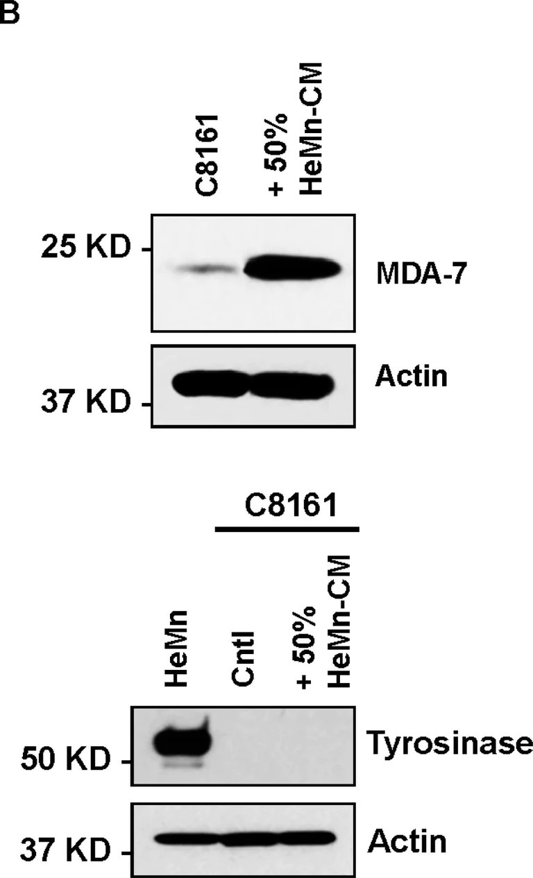 Western blot - Anti-IL-24 antibody (AB115207)