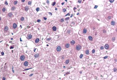 Immunohistochemistry (Formalin/PFA-fixed paraffin-embedded sections) - Anti-IL-25 antibody [68C1039.2] (AB115672)
