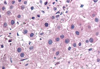Immunohistochemistry (Formalin/PFA-fixed paraffin-embedded sections) - Anti-IL-25 antibody [68C1039.2] (AB115672)