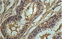 Immunohistochemistry (Formalin/PFA-fixed paraffin-embedded sections) - Anti-IL-25 antibody (AB108530)