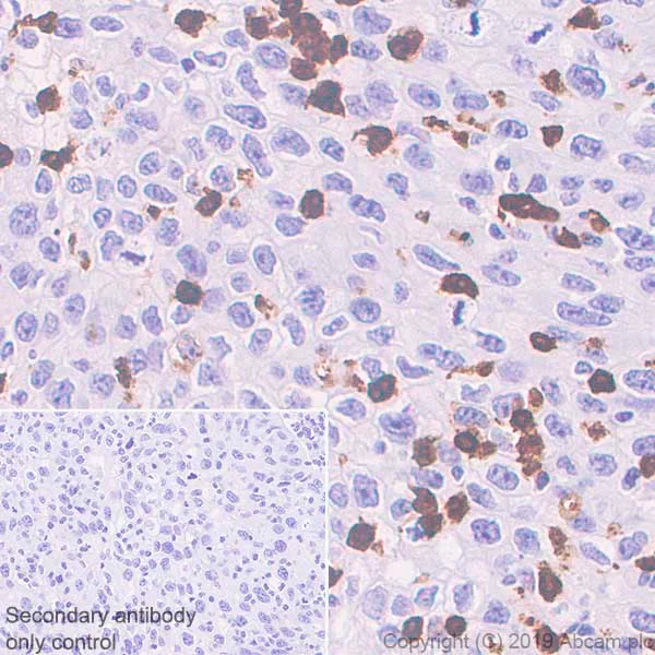 Immunohistochemistry (Formalin/PFA-fixed paraffin-embedded sections) - Anti-IL-26 antibody [EPR22268-141] (AB224198)